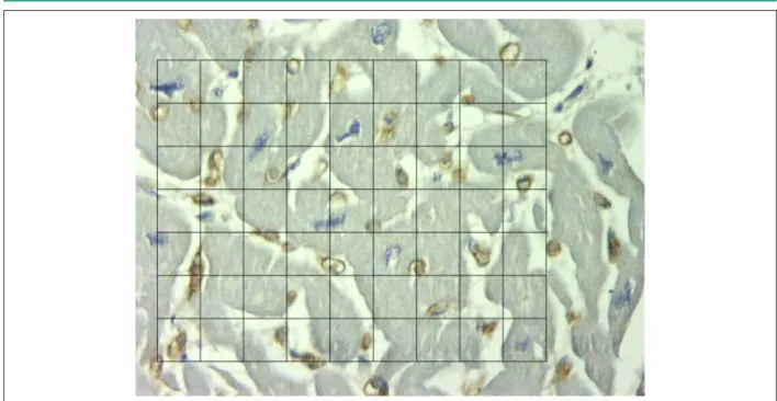 Fig. 3 -  Corte histológico de miocardio sometido a reacción de inmunohistoquímica para Factor VIII para determinación de la densidad numérica de capilares y mensuración  de la distancia de difusión de los mismos, presentando la reja de 80 puntos