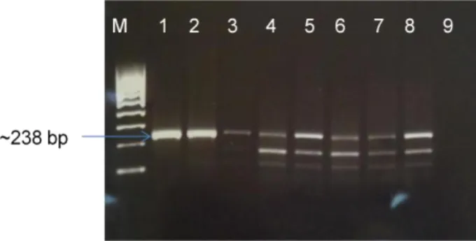 Figure  7 – Image of an agarose gel (1.5%) electrophoresis corresponding to the amplification of  β-actin  gene  from  DNA  samples  of  small  ruminants