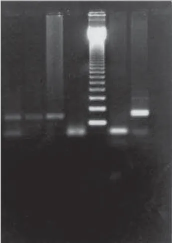 Figura 2  – Produto de PCR em gel de agarose. 1-3: Primer D7S666; 4 e 6: Primer D7S501; 5: Ladder 123bp; 7: Primer D7S471