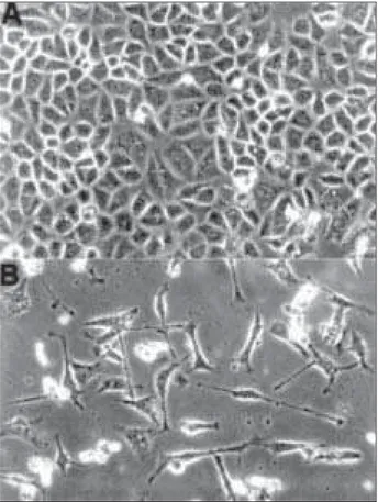 Figura 1  – Microscopia de contraste de fase. (A) Células normais da linhagem celular