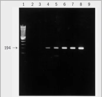 Figura 2  – Produtos de amplificação através de PCR simples com  primer  B1, curva de parasitas para avaliação da sensibilidade
