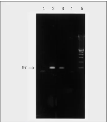 Figura 3  – Produtos de amplificação através de PCR  nested  com  primer  B1. Eletroforese em gel de agarose a 2% com brometo de etídio