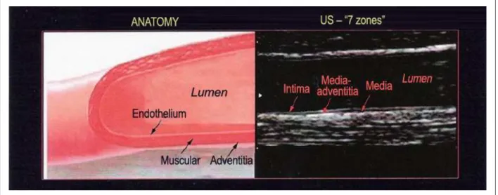 Figure 2 - Anatomy of the vessel layers on ultrasonography.