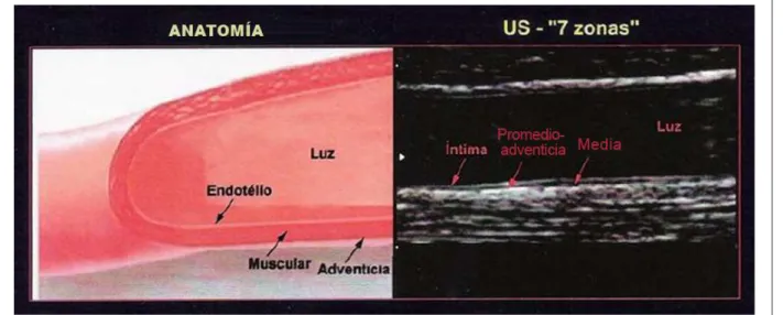 Figura 2 - Anatomía de las camadas del vaso sanguíneo en la imagen del ultrasonido.