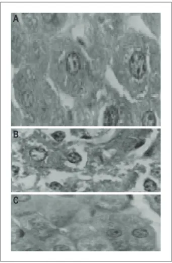 Fig. 5 – Histopathological analysis of the liver. Panel A shows the histological  section of liver from animals in the control group