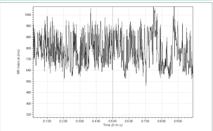 Figure 1 - Tachogram of the RR interval recording of a non-obese child in the supine position.