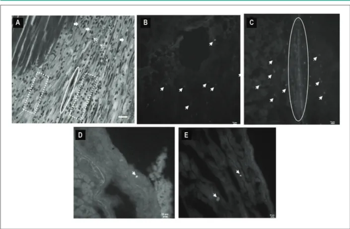 Figure 2 :  Photomicrograph of heart of animal 21 days post acute myocardium infarction, showing in A: Note granular tissue in cardiac tissue containing partially intact  longitudinal cardiac ibers (circle)