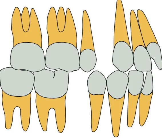 Figura 7: Esquema exodontia primeiro pré-molar superior e segundo pré-molar inferior. 