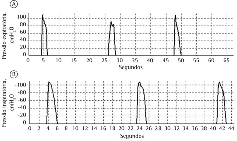 Figura 1 - Mensuração da PEmáx e da PImáx por meio de um manovacuômetro  digital (Sistema MVD300)