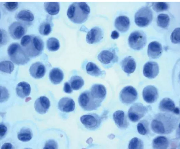 Figura 3 - Fotomicrografia mostrando macrófagos 