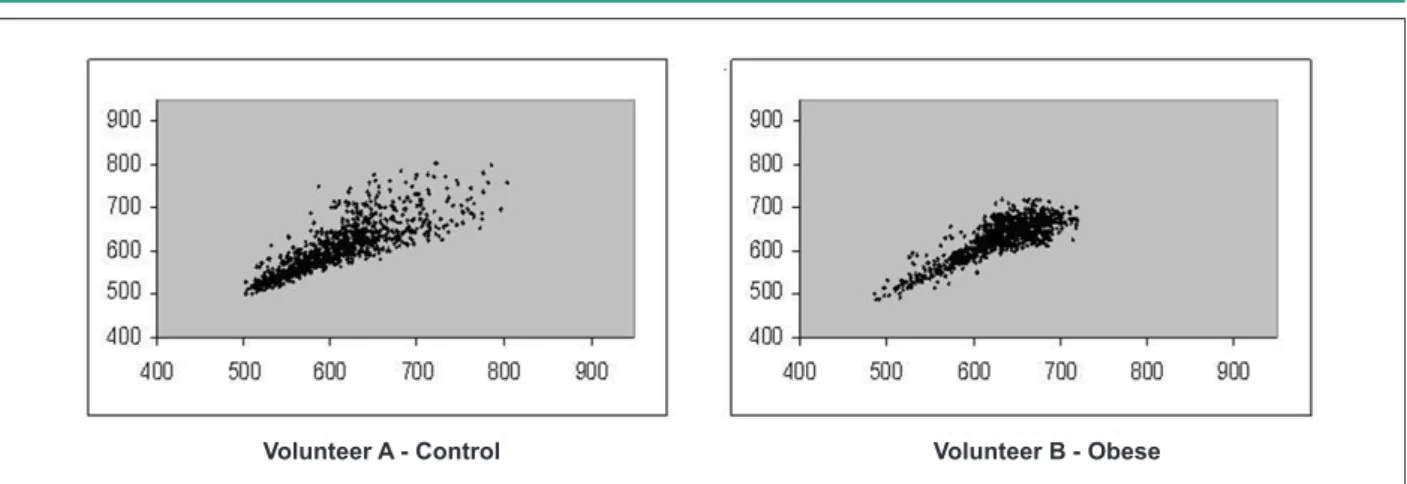 Figure 1 - Visual pattern of Poincaré plot observed in the eutrophic group (Volunteer A - SD1 = 24.1 and SD2 = 75.6) and obese (Volunteer B - SD1 = 17.0 and SD2 = 57.2).