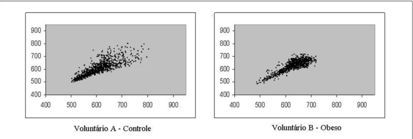Fig. 1 - Standard visual del plot de Poincaré observado en el grupo eutróico (Voluntario A – SD1 = 24,1 e SD2 = 75,6) y obeso (Voluntario B – SD1 = 17,0 e SD2 = 57,2).
