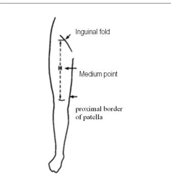 Figure 3 - Illustration of the anatomical place used for assessing the thigh’s  medium perimeter.