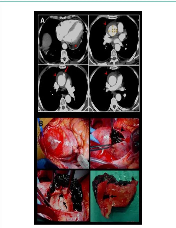 Figure 1 -  Panels A and B.