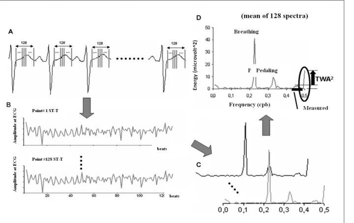 Figure 1 -  The four phases of the SM methodology. A) Selection of 128 equidistant points in the ST-T complex of a series of 128 beats from the ECG