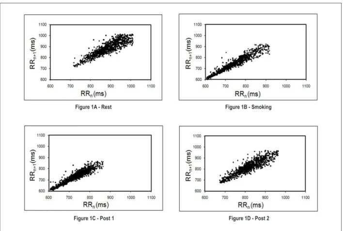 Figure 1 -  Visual pattern of Poincaré plot observed in smokers before (1A), during (1B) and after smoking (1C and 1D)