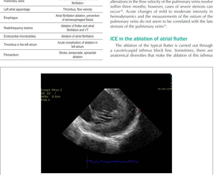 Table 2 - Structures/images visualized through the intracardiac  echocardiography that are useful for electrophysiology