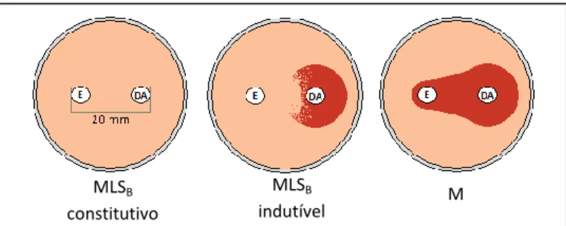 Figura  3.  Fenótipos  de  resistência  aos  macrólidos  em  Streptococcus  pyogenes.  (E),  eritromicina,  (DA),  clindamicina