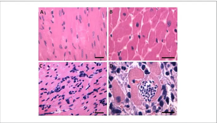 Figure 1 -  Representative photomicrographs of left ventricle of control (A and B) and infected (C and D) groups