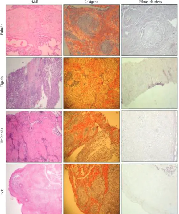 Figura 1 - Amostras de pulmão, linfonodo, fígado e pele coradas com H&amp;E, picrosirius (colágeno) e resorcina- resorcina-fucsina de Weigert (fibras elásticas)