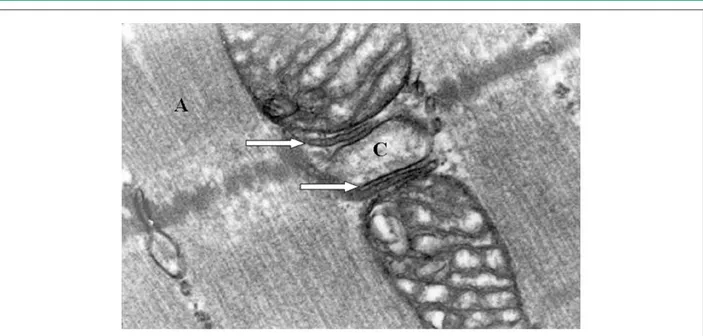 Figura 2 –  Fotomicrografía del tejido muscular del puente miocárdico en un corte longitudinal, presentando mioibrilas (A), mitocondrias (B), tubo T (C) y retículo  sarcoplasmático (→), ambos en forma de triade