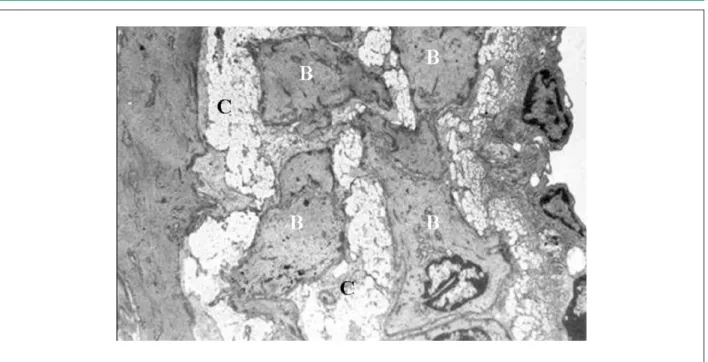 Figura 4 –  Fotomicrografía de la capa íntima, presentando la célula de espuma en la capa media (→), limitante elástica interna (A), células musculares lisas (B) y  matriz extracelular alterada (C)