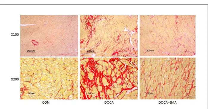 Figure 3 – Myocardial ibrosis in the two treatment groups on day 28 compared with the CON group (Sirius-Red staining, ×100 and ×400)