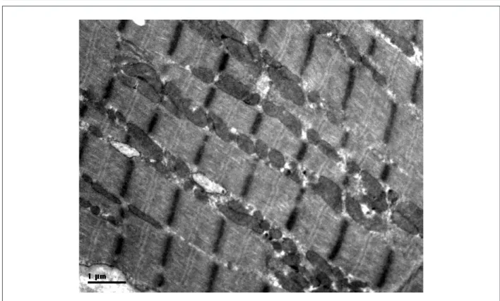 Figure 1 - Transmission electron micrograph of mitochondria in RVOT of an acyanotic patient (×8900, bar 1 μm).