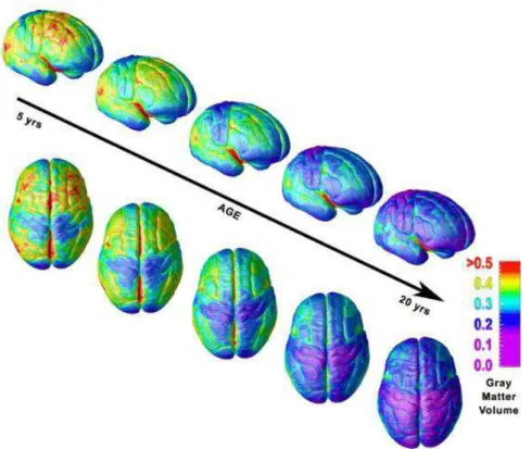Figura  2  –  Ilustração  por  imagem  de  ressonância  magnética  (MRI,  magnetic  resonance  imaging)  da  maturação  do  volume  de  massa  cinzenta  através  da  superfície cortical entre 5 e 20 anos de idade