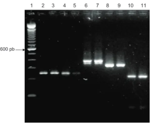 Figura 4. Amplificações, por PCR, dos VNTRs das culturas de  Y. pestis com os primers 1AB, Linhas 1: “100 bp DNA ladder”, 2: 