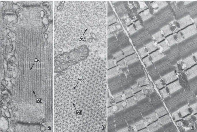 Figura 3. Micrografias eletrônicas de transmissão de uma secção longitudinal (a) e transversal (b) de uma célula (fibra) muscular es- es-quelética, mostrando um sarcômero, no qual se observam os miofilamentos de miosina, filamentos mais eletrodensos (Mi), 