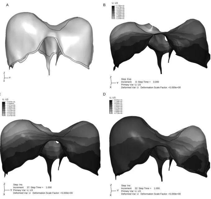 Figure 10 illustrates the movement of the diaphragm at the end of inspiration in all the three cases