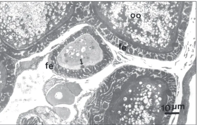 Fig. 1 — Micrograph of thick a section from material processed to electron microscopy stained with toluidine blue