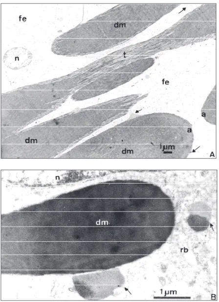 Fig. 4 — Additional aspects of the dense material (dm). A. Fibrilar nature of the dense bodies (dm) and the amorphous less denser periphery
