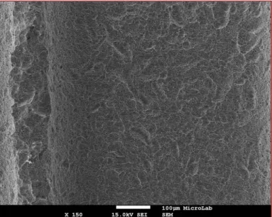FIGURE 8 - Biomet-Zimmer® T3 surface at 150x Magnification. We can see the microgeometry    produce by sandblasting and acid-etching the surface