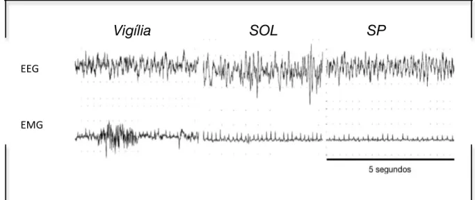 Figura  2.   Exemplo  do  traçado  do  perfil  de  EEG  e  EMG  em  humanos,  referente  à 