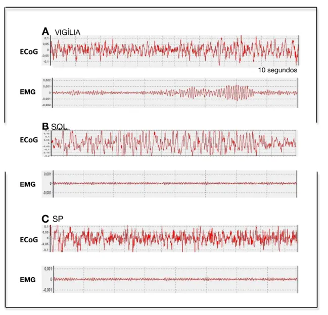 Figura 11 . Imagem representativa do perfil de ECoG e EMG correspondente ao  estágio  de  Vigília  (A),  SOL  (B),  e  SP  (C)  em  rato