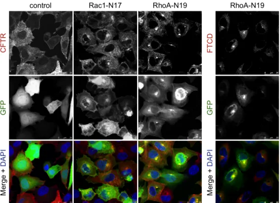 Figure  3.4.  Confocal  immunofluorescence  microscopy  of  BHK-wt  cells,  showing  CFTR,  Golgi  FTCD  protein  and  small  GTPase  expression