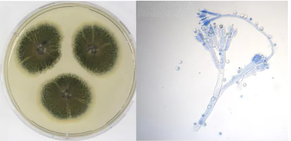 Figure 1.3 - Macro- and micromorphology of A. fumigatus (MUM 14.30), after 3 days growth in MEA at 37 ºC