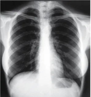 Figura 2 - Radiografia no oitavo dia de pós-operatório, 