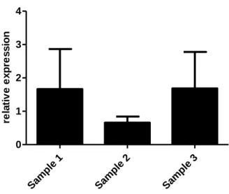 Figure  11|  Jagged2  expressed  in  peripheral  blood  mononuclear  cells.  Quantification  of  the  samples that expressed Jagged2