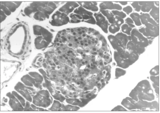 Fig. 6 — Micrography of a pancreatic islet form a Px (25) group rats, thats exhibits a great amount of intracytoplasmatic vacuoles and reduced number of cells (HE, 500x).