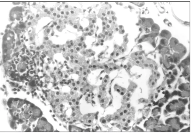 Fig. 7 — Pancreatic islet from an Alx group rat, that exhibits a strong reduction in the number of cells and focal inflam- inflam-matory infiltration (HE, 400x).