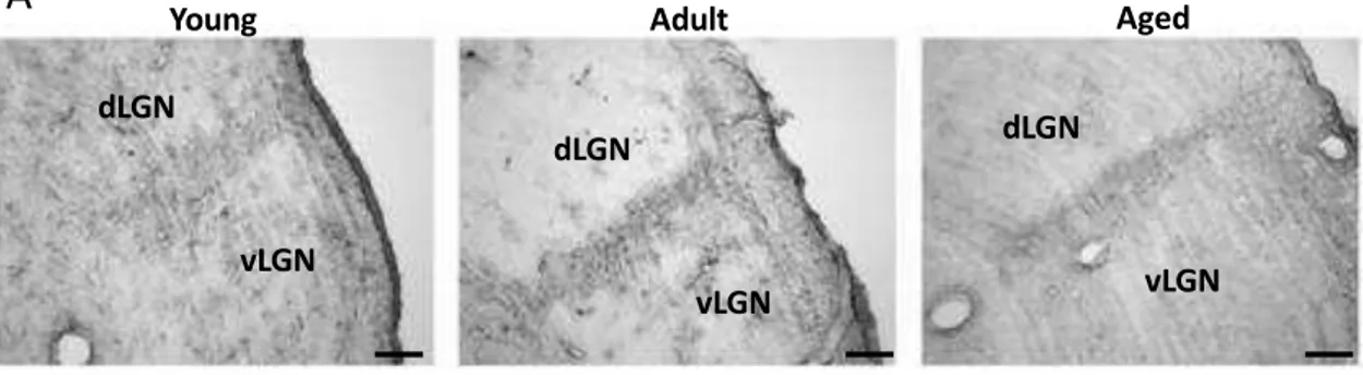 FIGURE  3.  A:  digital  images of coronal sections,  at thalamic  level, of rat brain processed  by  immunostaining  for  GFAP