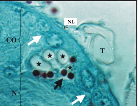 Figure 3. Photomicrography of nerve ganglion in 5 th -instar B. mori caterpillar, on the 6th day p.i