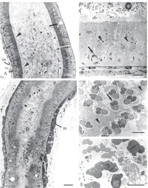 Fig. 3. Light (A and B) and transmission electron (B, D and E) micrographs of seminal vesicles