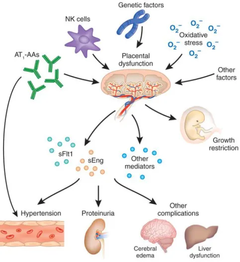 Figure  1.1  Pathogenesis  of  preeclampsia.  (Power  et  al.,  2011)  (Reprinted  with  permission  from  Wolters Kluwer Health, Inc.)  AT 1 -AAs: Angiotensin II Type I Receptor Activating Autoantibodies; NK cells: Natural Killer  cells; sFlt1: soluble Fm
