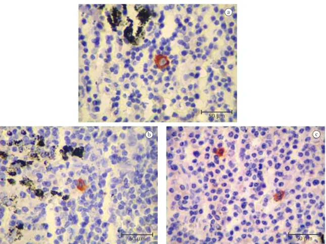 Figura 1 - Imunohistoquímica em linfonodos pN0 ressecados de pacientes com câncer de pulmão não-pequenas células