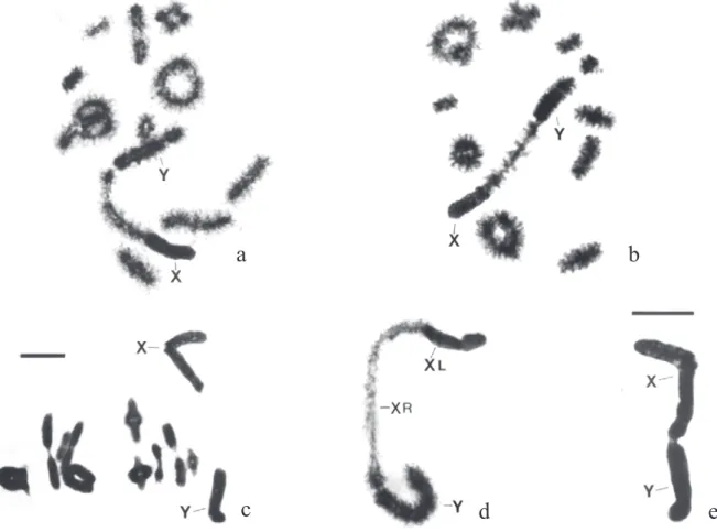Fig. 4. R. ommexechoides. a) diakinesis. b) idem. c) first metaphase. d) neo XY pair with distal contact between Y and XR during diplotene stage