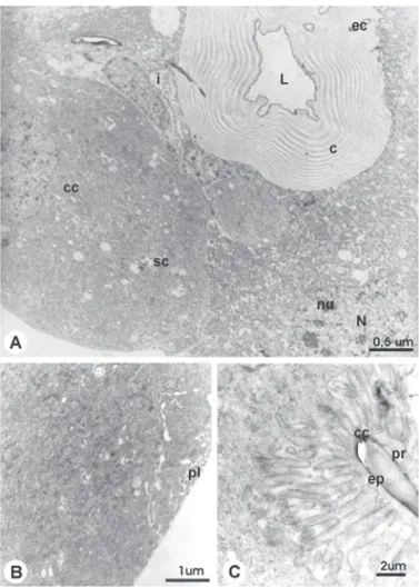 Figure 1. TEM micrographs showing the venom gland general organization of newly-emerged worker of A